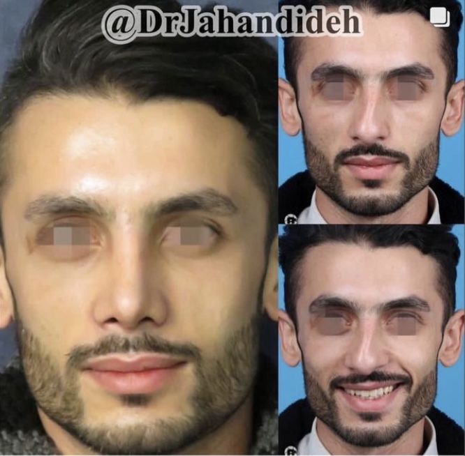 ECCEFED5 E2FC 4162 8B2C 9BA1B3F0C443