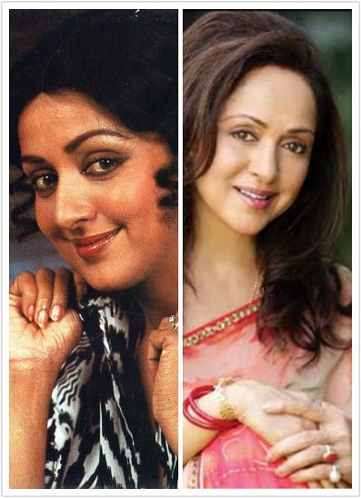 Best bollywood actresses who have gone fairness skin lightening treatment 3