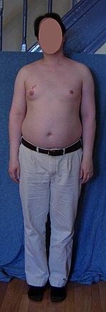 Bodymorphproj mkg modA001 20070325 pos03