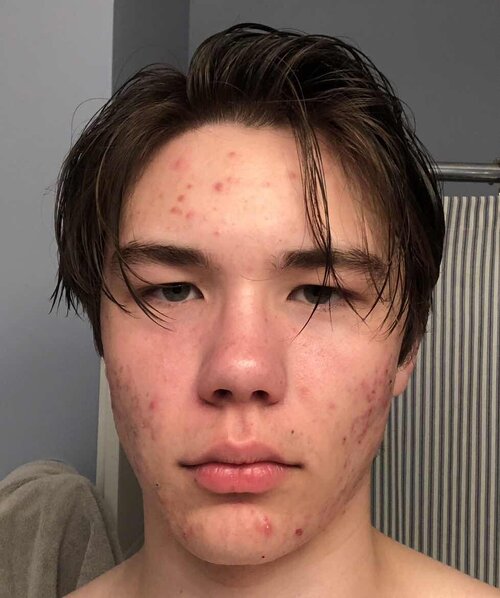 IMG 0471