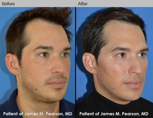 James pearson md