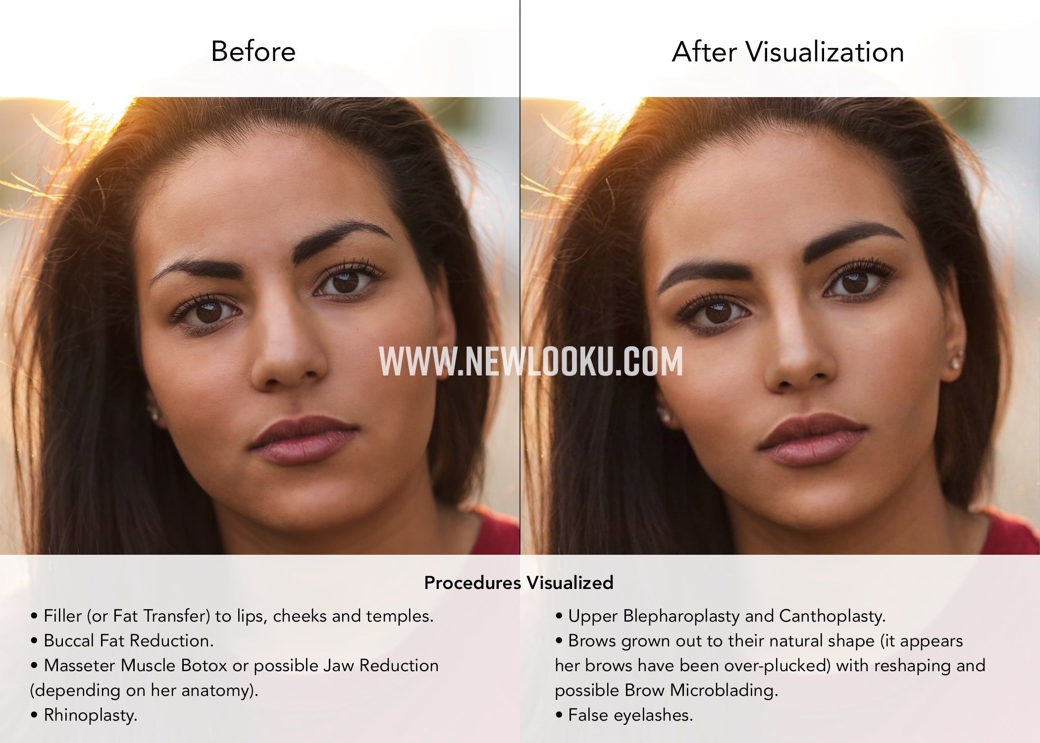 SA before and after website 25 April 22