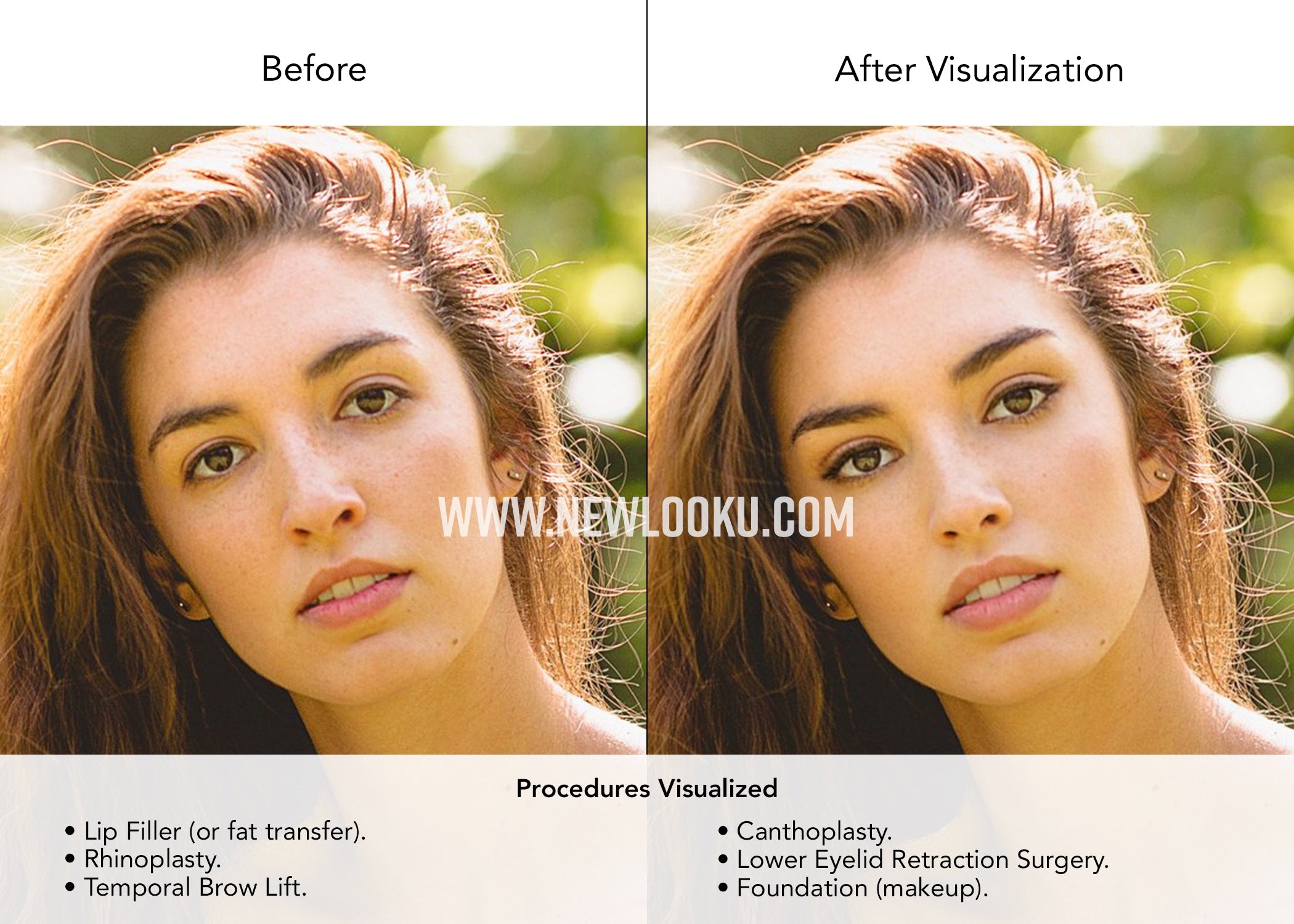 725 KB Auburn before and after website 26 April 22