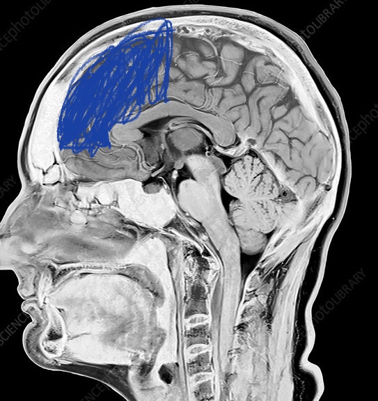 72B01F25 AD58 47DA 91C2 BCF823D6E9F8