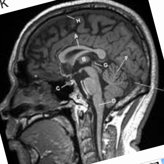 A8A11589 B4FA 49A3 9574 9E3BB0A189F5