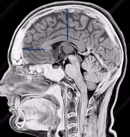 CD3CBD51 571D 458C 96AC CD019A2885F3