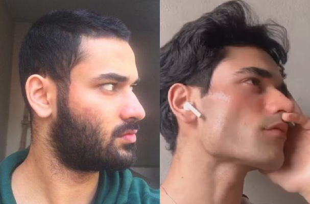 Salludon before after