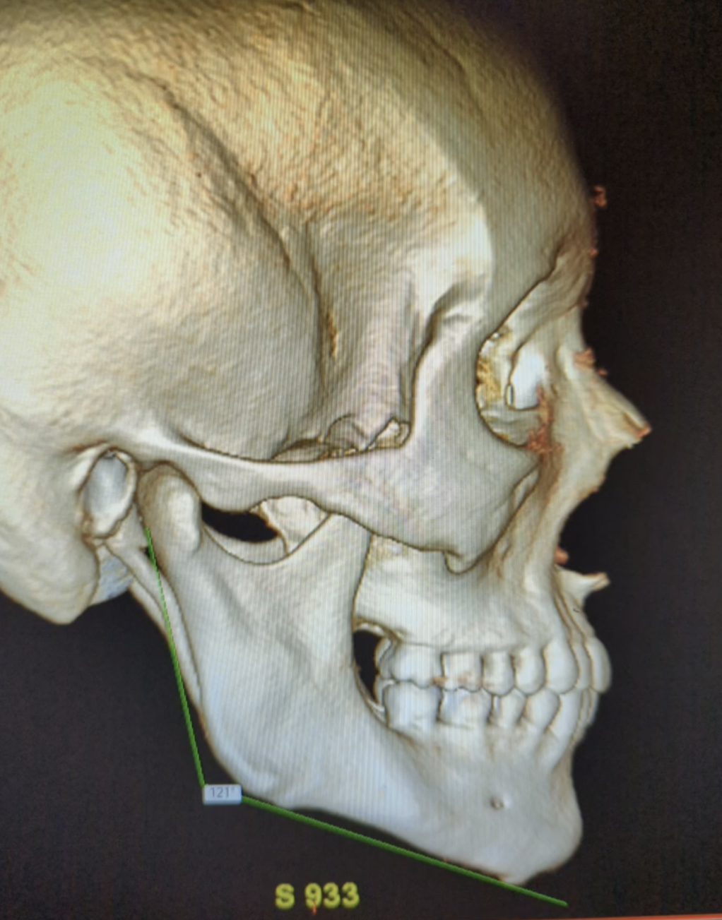 Screenshot 20230620 061041