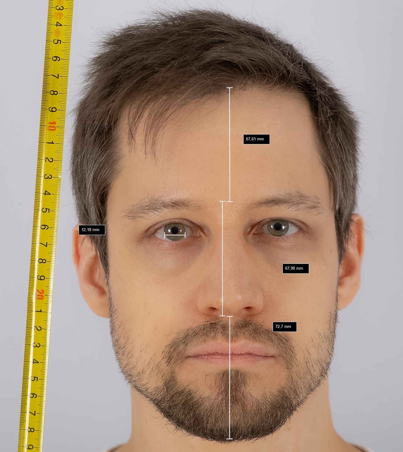 Measure 1