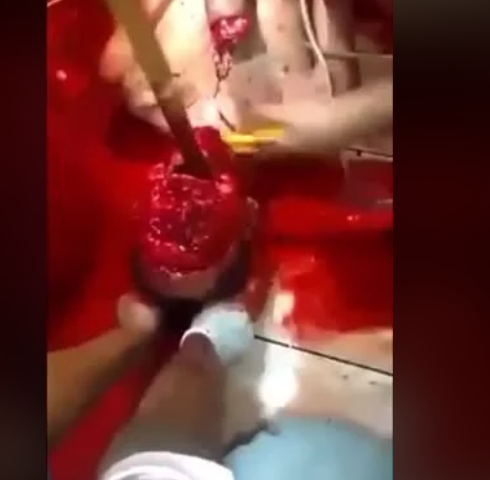 GORE