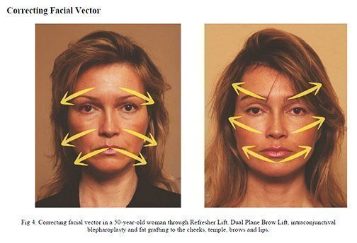 Facial vectors 01