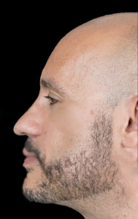 3520561 IMG 20230711 075237