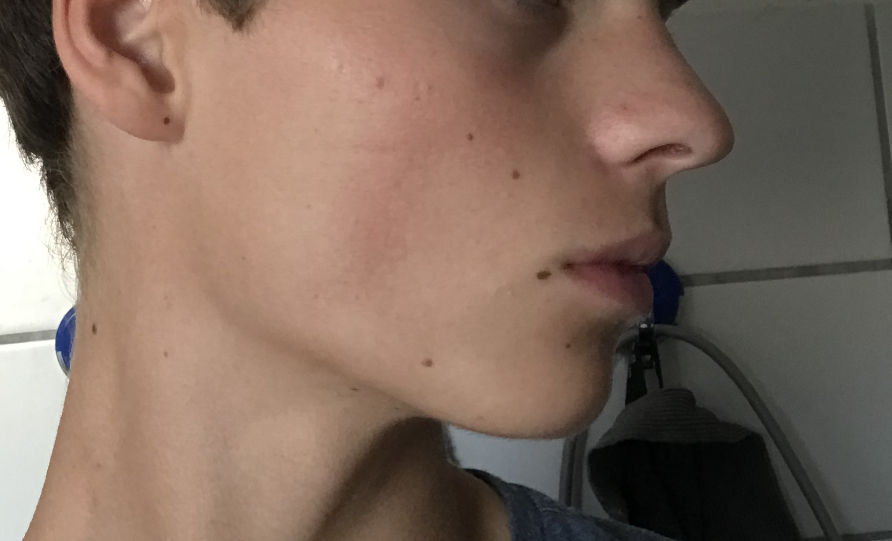 IMG 0781