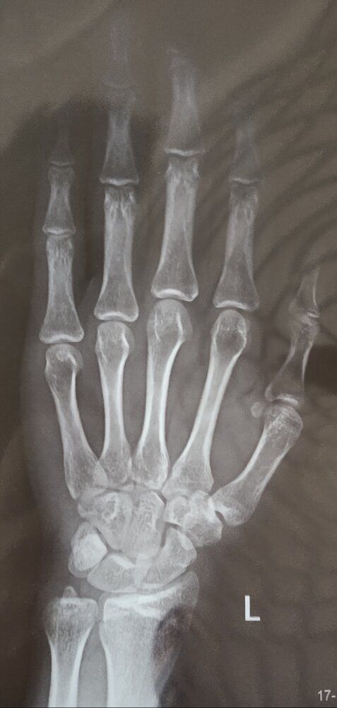 1751720 IMG 20200506 175504