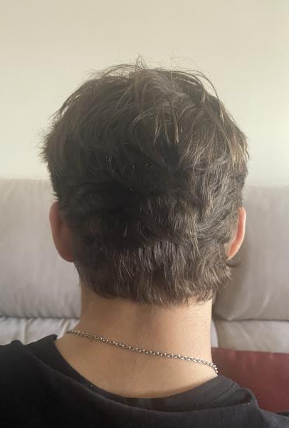 Hair