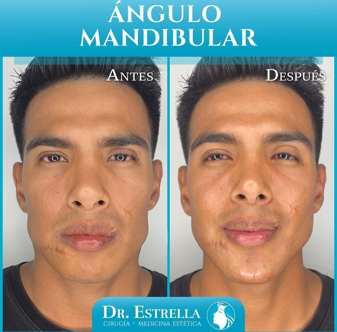 PhotoEditor 20230717225118