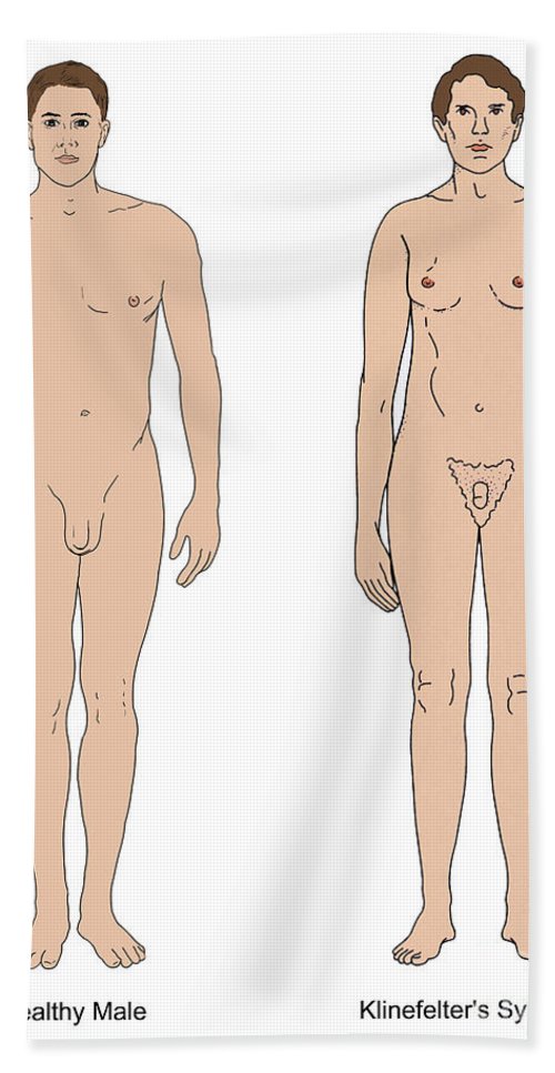 Klinefelters syndrome  healthy male science source