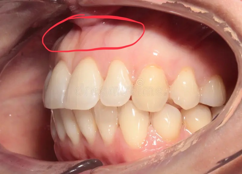 3E9220DE ECB7 490A BFCE C3FC74D48807