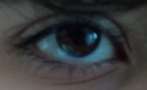 Eyes