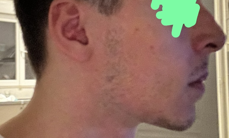 IMG 1376