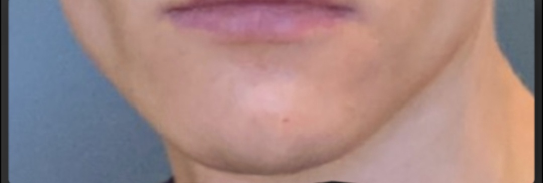 Screenshot 20230725 124452 Plastic Surgery Simulator