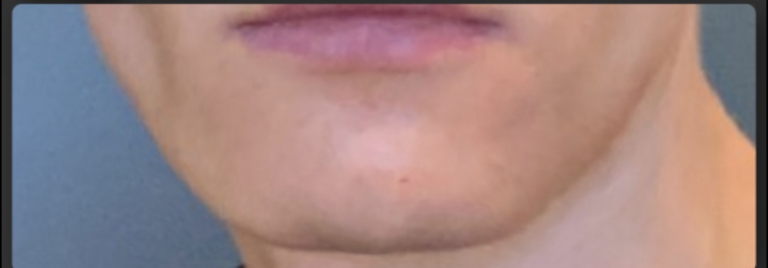 Screenshot 20230725 124719 Plastic Surgery Simulator