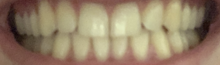 IMG 2455