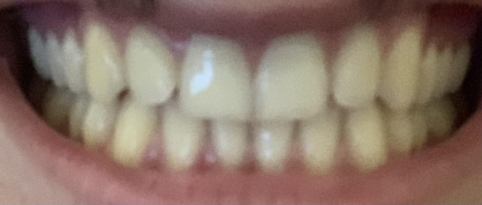 IMG 2514