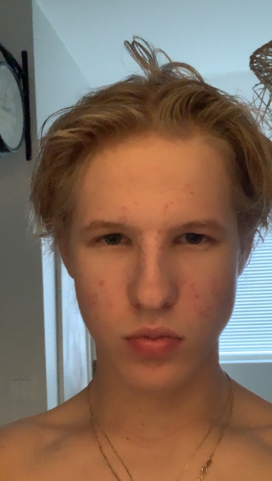Elvis4