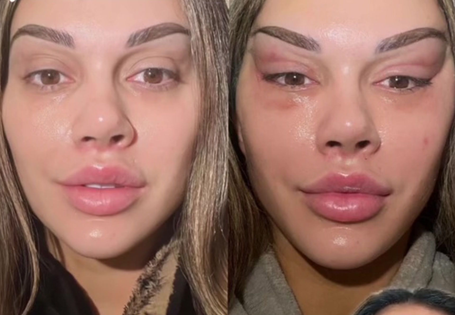 Fox eye surgery