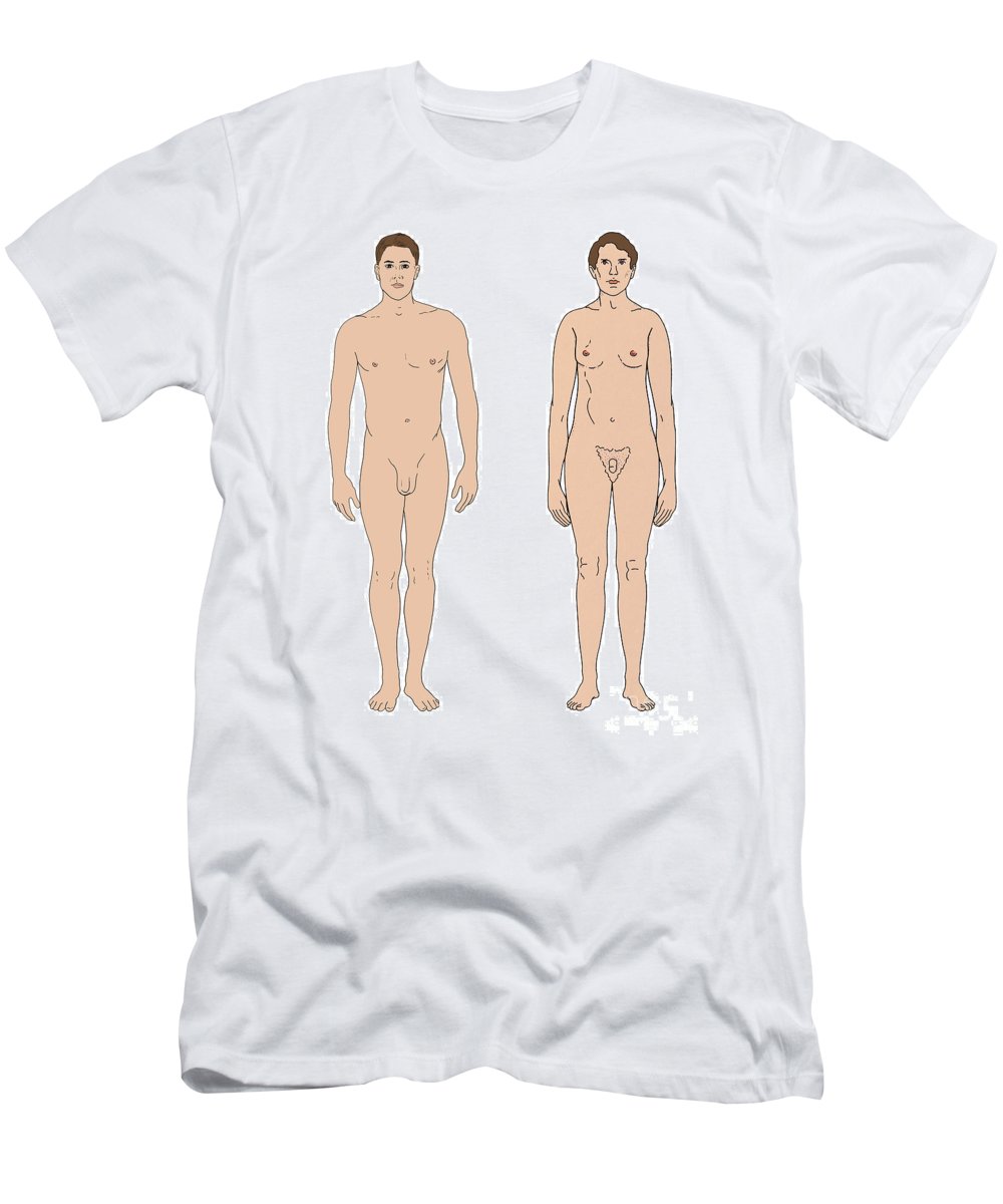 1 klinefelters syndrome  healthy male science source