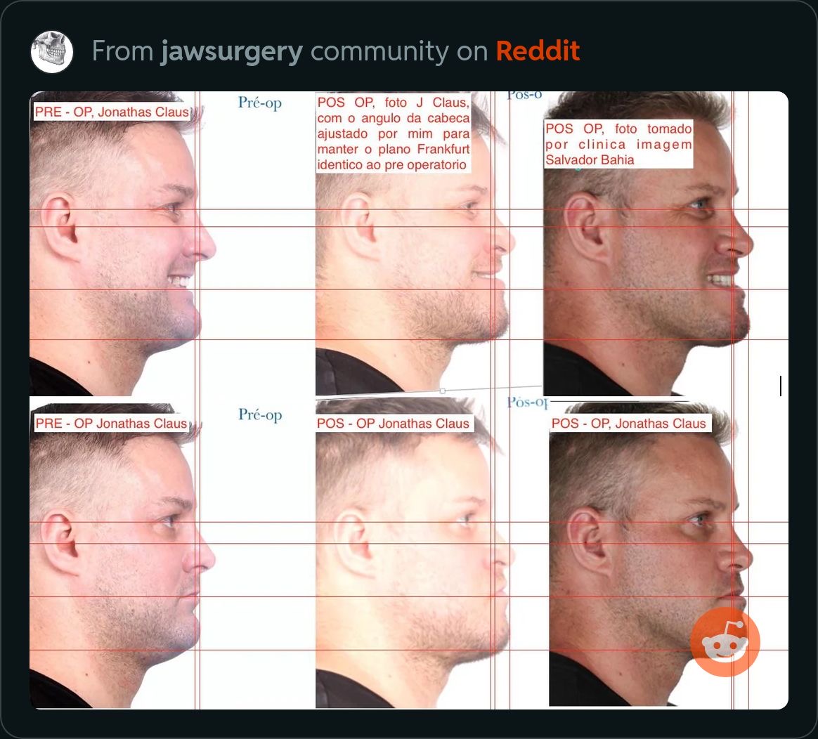 3516723 8B8D7B05 D971 49CB BE55 0F5E6049E275
