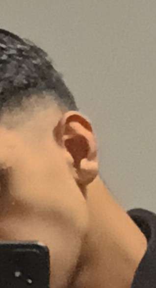 1000000172