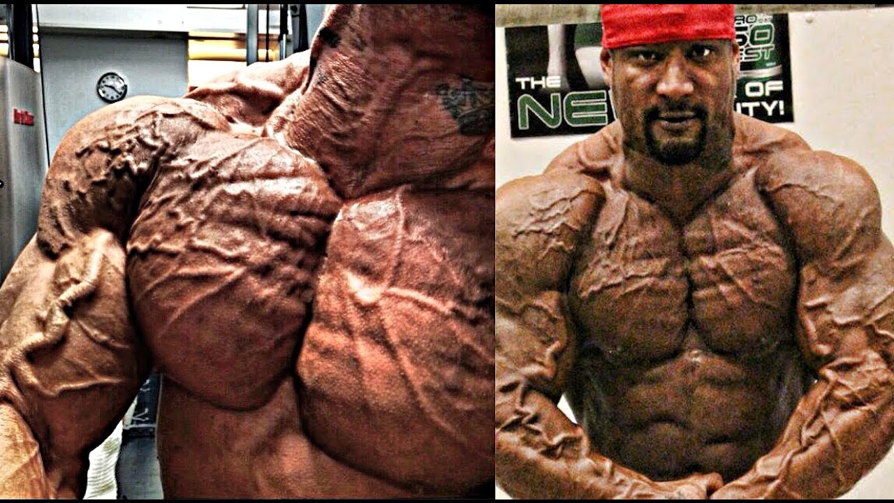 Vascular1