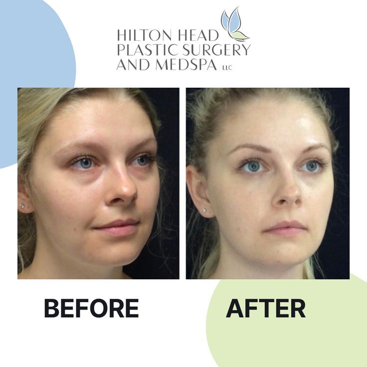 Cd43889c321968b8e4aec21c3a71cfe3