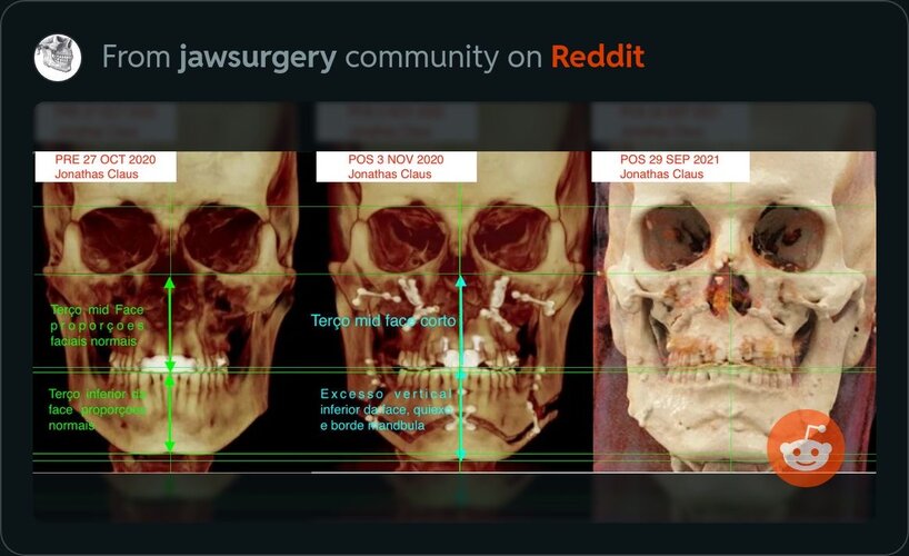 4C0C03B0 41D2 4B8E 8945 CE522F5206CE