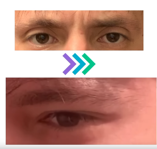hoodedbotox.PNG