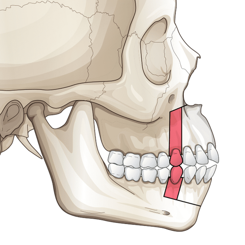 1763313 img twojaw threejaw 2 1