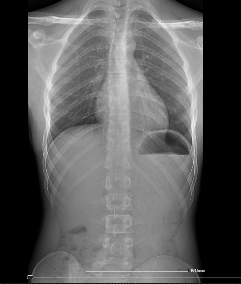 Captura de Ecr 32