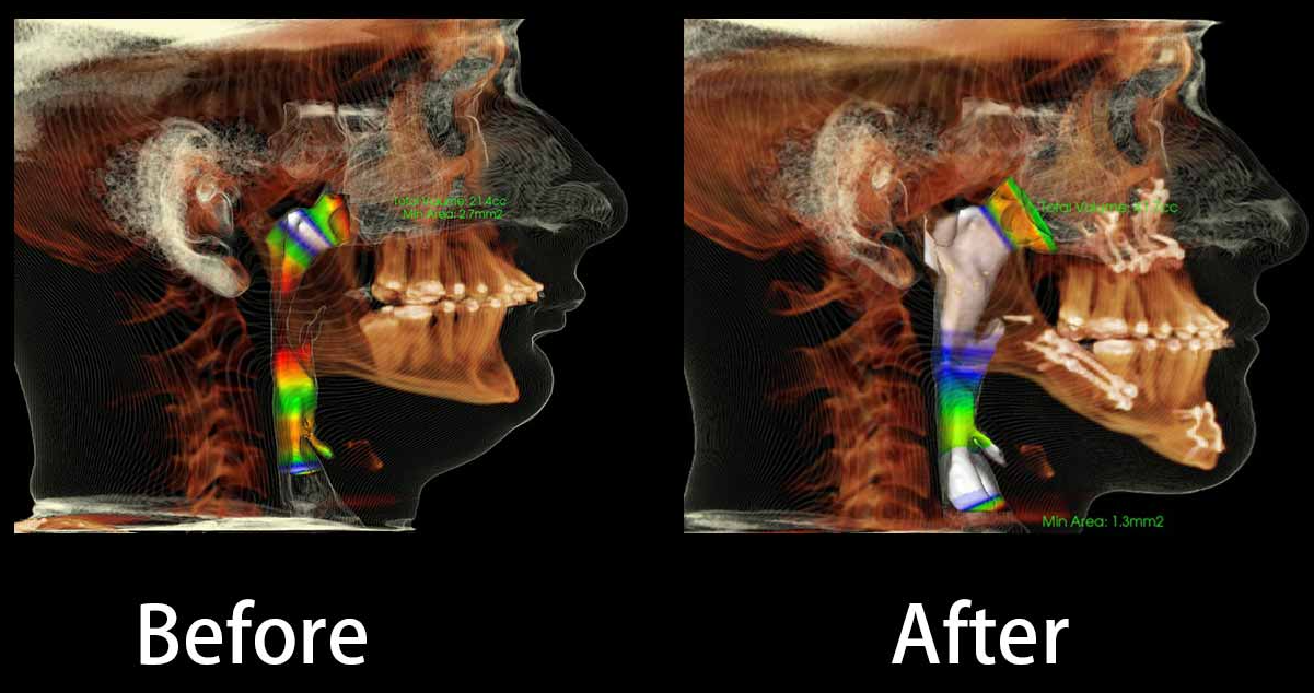 Trimax xray