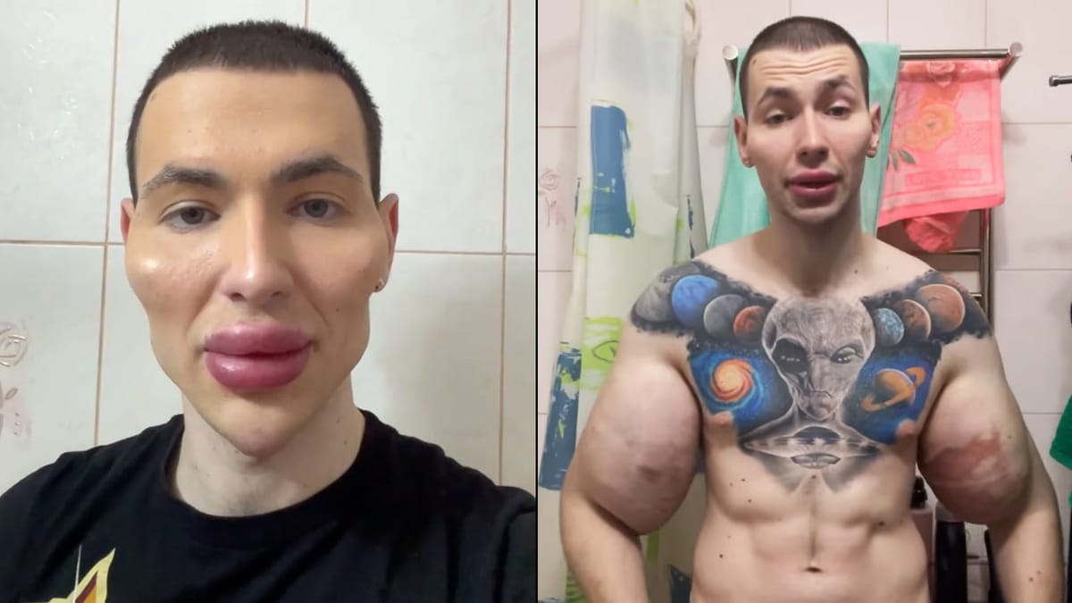 Synthol kid alien injection face