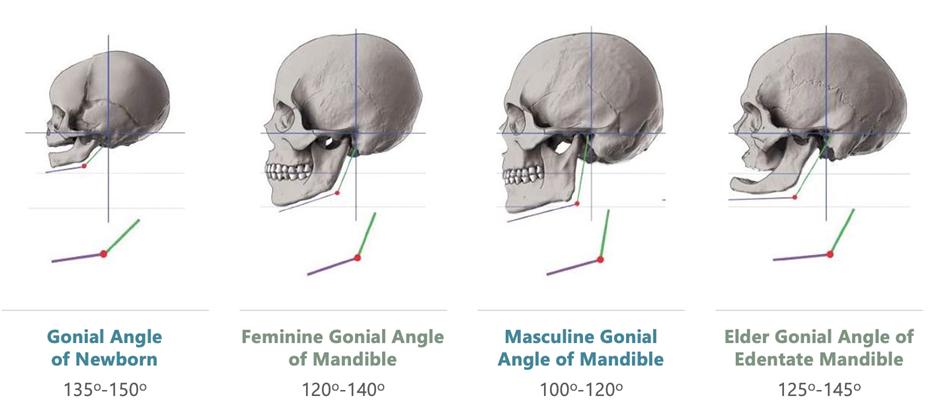 Gonial angle