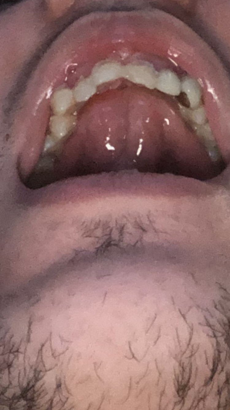 IMG 3825