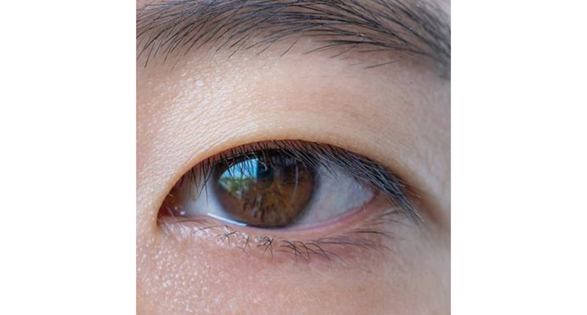 Eye with monolid