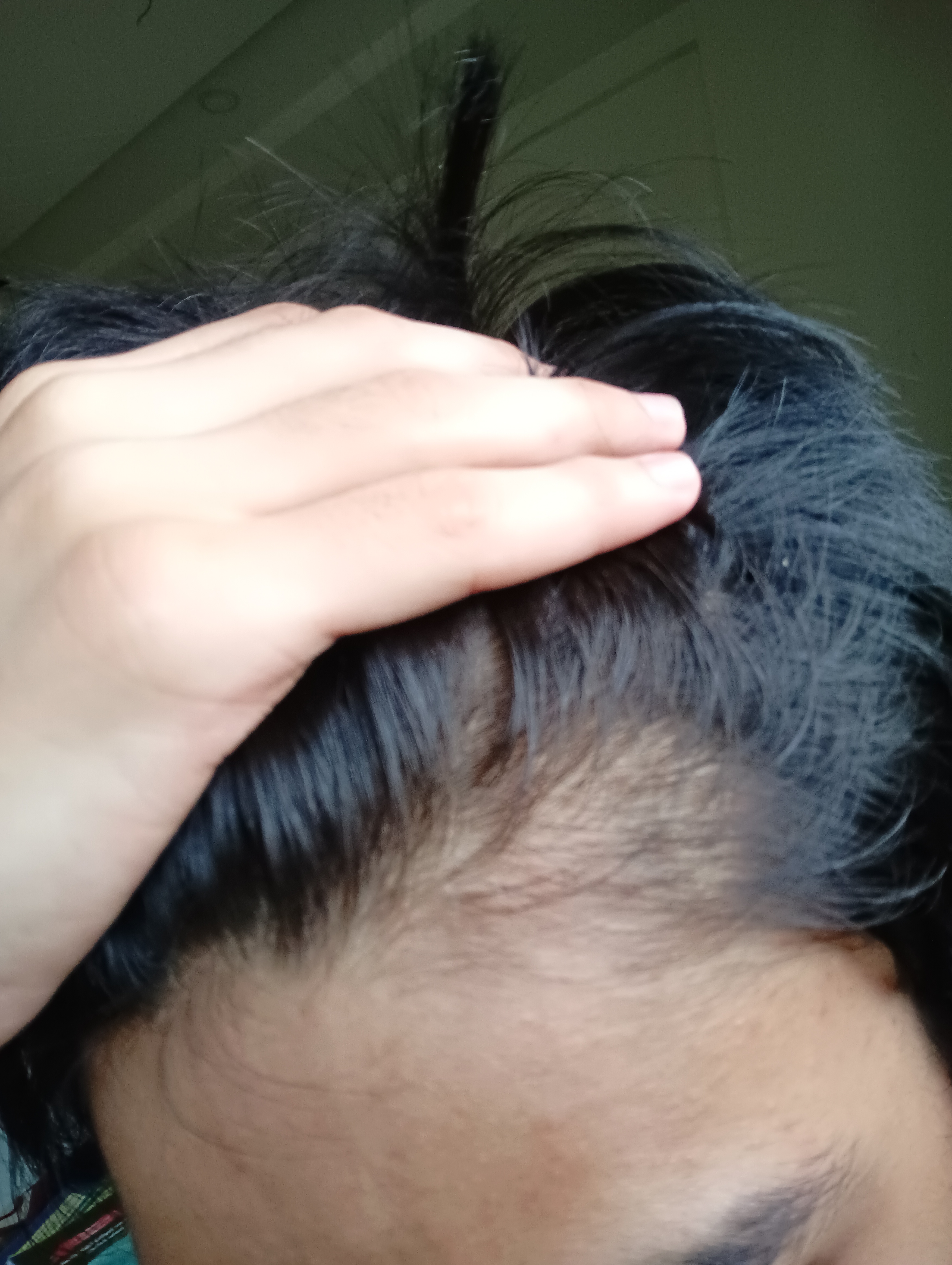 1000102204