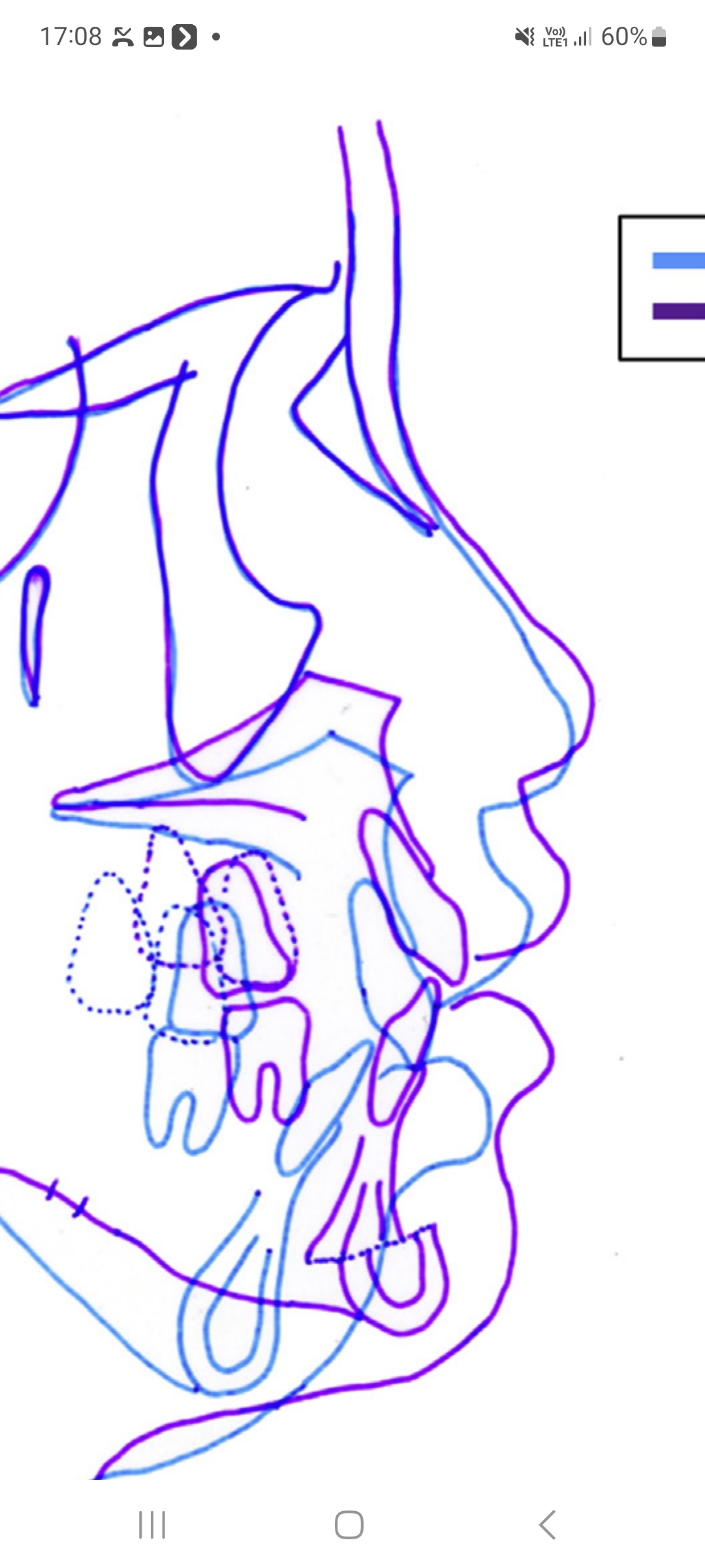 Screenshot 20230626 170839 OneDrive