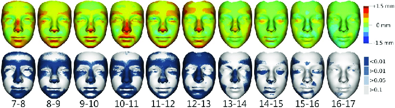 Visualization of facial growth changes between the ages of 7 and 17 years in girls Shell