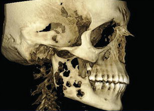 CBCT2