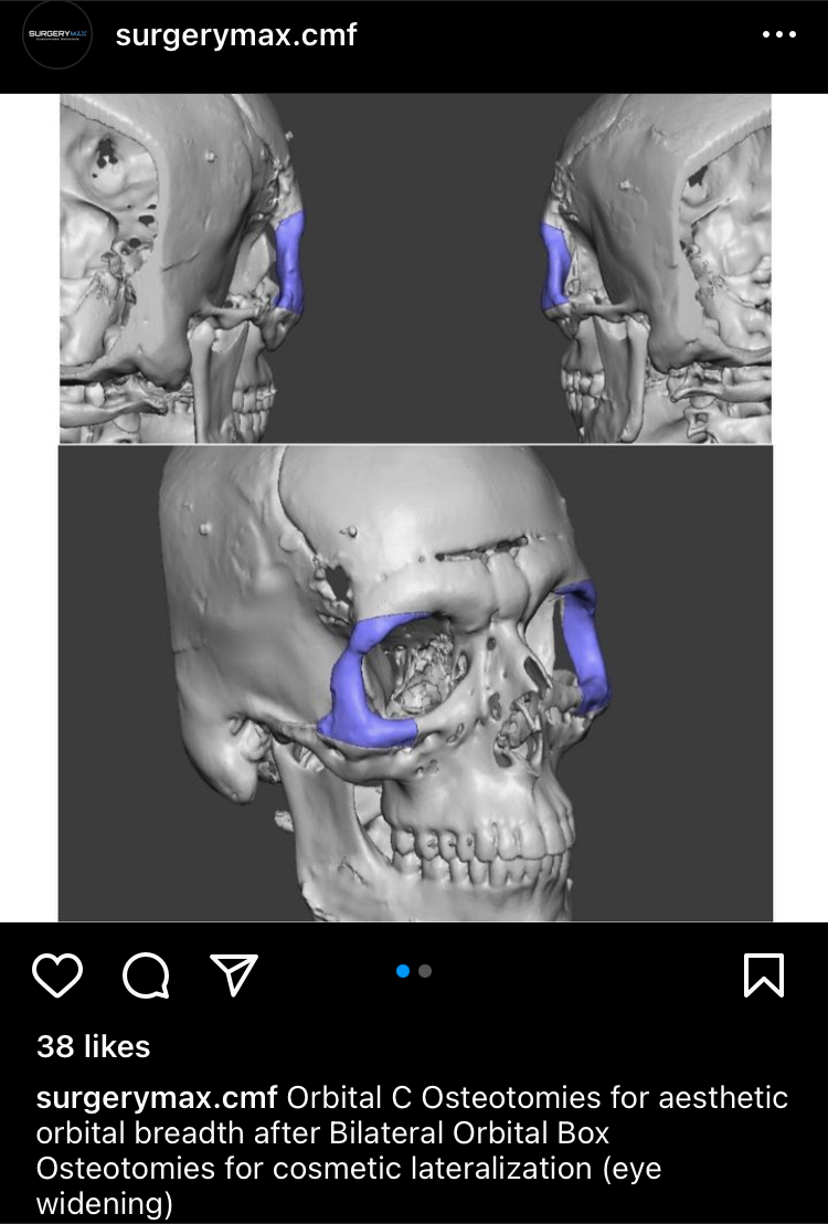 03B1416F 6645 4828 9380 E9BD44CDA274