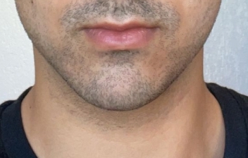 Screenshot 20230821 113441 DuckDuckGo